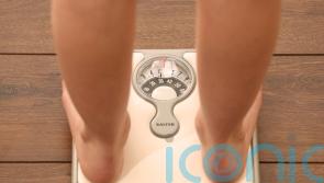 People ‘being misdiagnosed’ on obesity, say experts