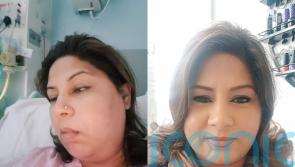 Buckets of blood: Mum gets £8,500 settlement after tooth extraction fractures jaw and puts her in intensive care