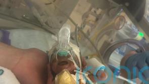 Parents praise medical staff for saving daughter born weighing just one pound