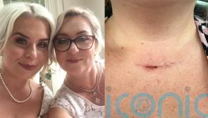 Mum and daughter hit by thyroid cancer diagnoses months apart after health workers thought they had menopause and asthma