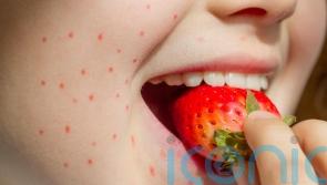 8 signs of food allergies in children you might not know