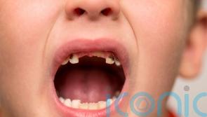 Amount of five-year-olds with rotting teeth rising in parts of England – data