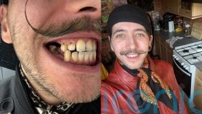 ‘NHS dentists don’t take my phobia seriously’ says man so fearful of a check up he has let his teeth ‘crumble away’