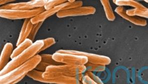 UK could lose low TB status amid rising cases, officials warn
