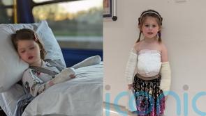 Girl, three, whose skin ‘fell off’ after accident with boiling water says she wants to become a nurse to help others