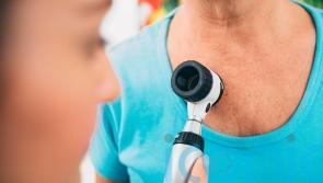 Patients with advanced skin cancer to test a new vaccine in NHS drive