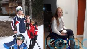 Active mum had leg amputated while awake after running pain in knee turned out to be peach-sized tumour