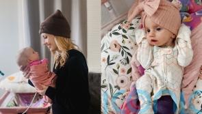 Mum of baby born with eyes wide open due to facial paralysis can sense daughter’s happiness even though she can’t smile