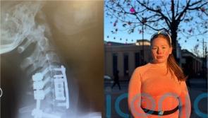 Woman who ‘partially decapitated’ herself after diving into pool and breaking neck on holiday ready for London Marathon