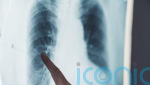 AI model being trained with NHS data from 57m people ‘could predict disease’