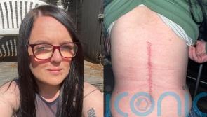 Mum found with large spinal cord tumour after 10 years of back pain will have to walk down the aisle on crutches