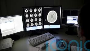 ‘Hope on the horizon’ as drugs assessed for Alzheimer’s prevention