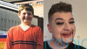 Intersex activist who felt like ‘alien’ for years campaigns for mandatory newborn screening to help end silent suffering