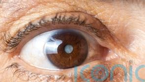 How to spot the early signs of a cataract