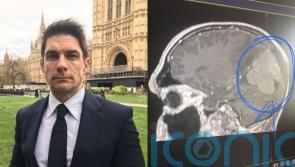Actor who ‘nearly died’ after lime-sized tumour grew undetected and ‘deformed’ skull feels lucky to finish latest film