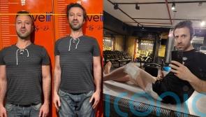 ‘Short king’ pays £36k on surgery to break legs and increase height by 3.7in after feeling arms were ‘too long’ for body