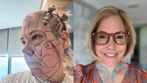 Mum, 52, whose face ‘looked sad all the time’ now told she looks ’20 years younger’ after rumoured Kris Jenner facelift
