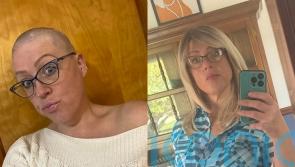 Widow who shaved her head after ‘manias’ caused her to spend hours pulling hairs from scalp says she ‘loves being bald’