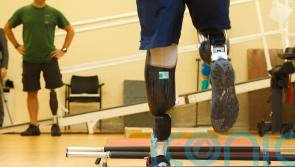 New software could reduce NHS waiting lists for prosthetic legs, study finds