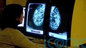 HSE says ‘problem’ with viewing BreastCheck register will be fixed next week