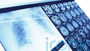 Minister admits it may take decade for full rollout of lung cancer screening