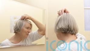 5 reasons you may be losing your hair and how to prevent it