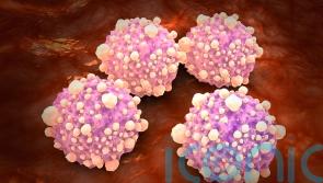 Mouth bacteria may increase pancreatic cancer risk threefold, experts say