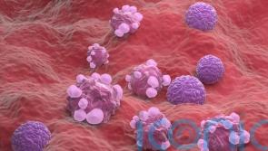 NHS hospital becomes first to offer new ovarian cancer surveillance test