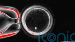 Scientists find way to fertilise eggs made from genetic material of skin cells