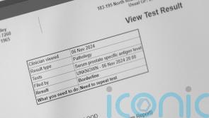 Prostate cancer blood tests ‘can lead to men being over-tested’, experts say