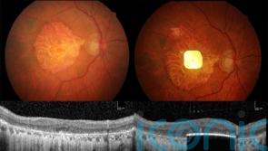 What is the Prima device and how does it work?
