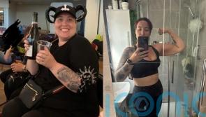 Woman who lost half her body weight after gastric band surgery says she now understands ‘thin privilege’
