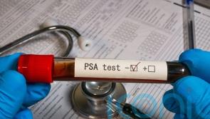 Study shows prostate cancer screening can ‘reduce deaths’ as UK scheme assessed