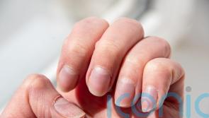 What the look of your nails says about your health