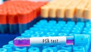 Trial for prostate cancer treatment with fewer side-effects launches in UK