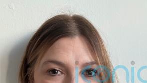 Woman who lost vision from rare condition hails &lsquo;phenomenal&rsquo; new treatment