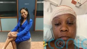 Woman, 40, who had two strokes thought she could &lsquo;live with&rsquo; high blood pressure but &lsquo;never imagined it would nearly kill me&rsquo;