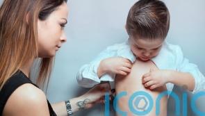 6 subtle warning signs of measles in children &ndash; and how to prevent it