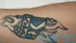 Gardai release tattoo image to help identify Temple Bar attack victim