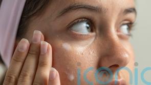 How to get rid of &lsquo;milk spots&rsquo;