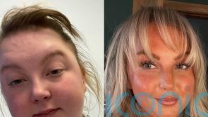 Woman who drank two litres of gin a day set to run half marathon for charity