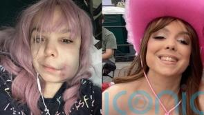 Ultramarathon runner, 26, &lsquo;grieves&rsquo; former self after arthritis diagnosis and now finding daily tasks &lsquo;impossible&rsquo;