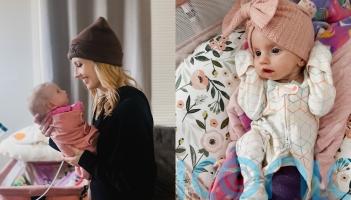 Mum of baby born with eyes wide open due to facial paralysis can sense daughter’s happiness even though she can’t smile