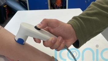 University hails £475,000 fund into ‘groundbreaking’ eczema technology