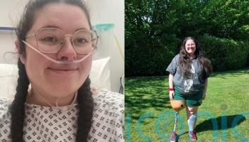 NHS nurse who had leg amputated after rare tumour found in calf says going into ‘survival mode’ helped her ‘stay positive’