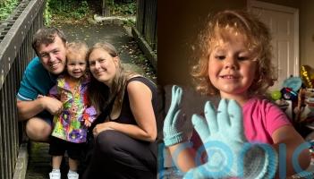 ‘Hopefully she will forget’ – Mother of girl, three, who lost fingers and toes to sepsis continues to ‘deal with trauma’