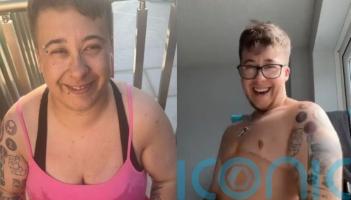 Trans man felt like he ‘won the lottery’ after having top surgery and getting the ‘dad bod’ he’d always wanted