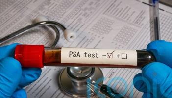 Prostate cancer screening: Committee says no to testing all men