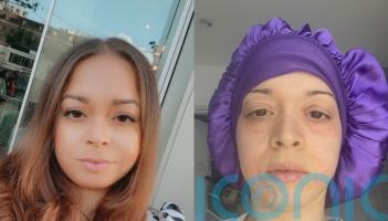 Mother believes she has &lsquo;overgrowth&rsquo; of skin&rsquo;s naturally occurring mites and feels them &lsquo;scurrying over her 24/7&rsquo;