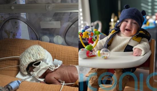 &lsquo;Our baby was born at 23 weeks weighing 800g &ndash; we were repeatedly told he might not make it but he&rsquo;s just turned one&rsquo;